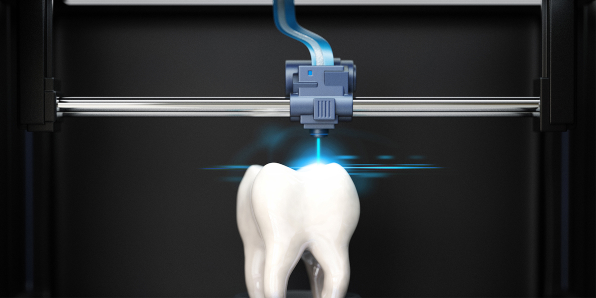 A Comprehensive Overview of Stereolithography (SLA)