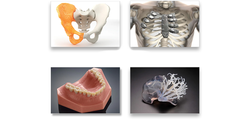 3D Printing vs Injection Molding: Making the Right Choice for Your Plastic Parts